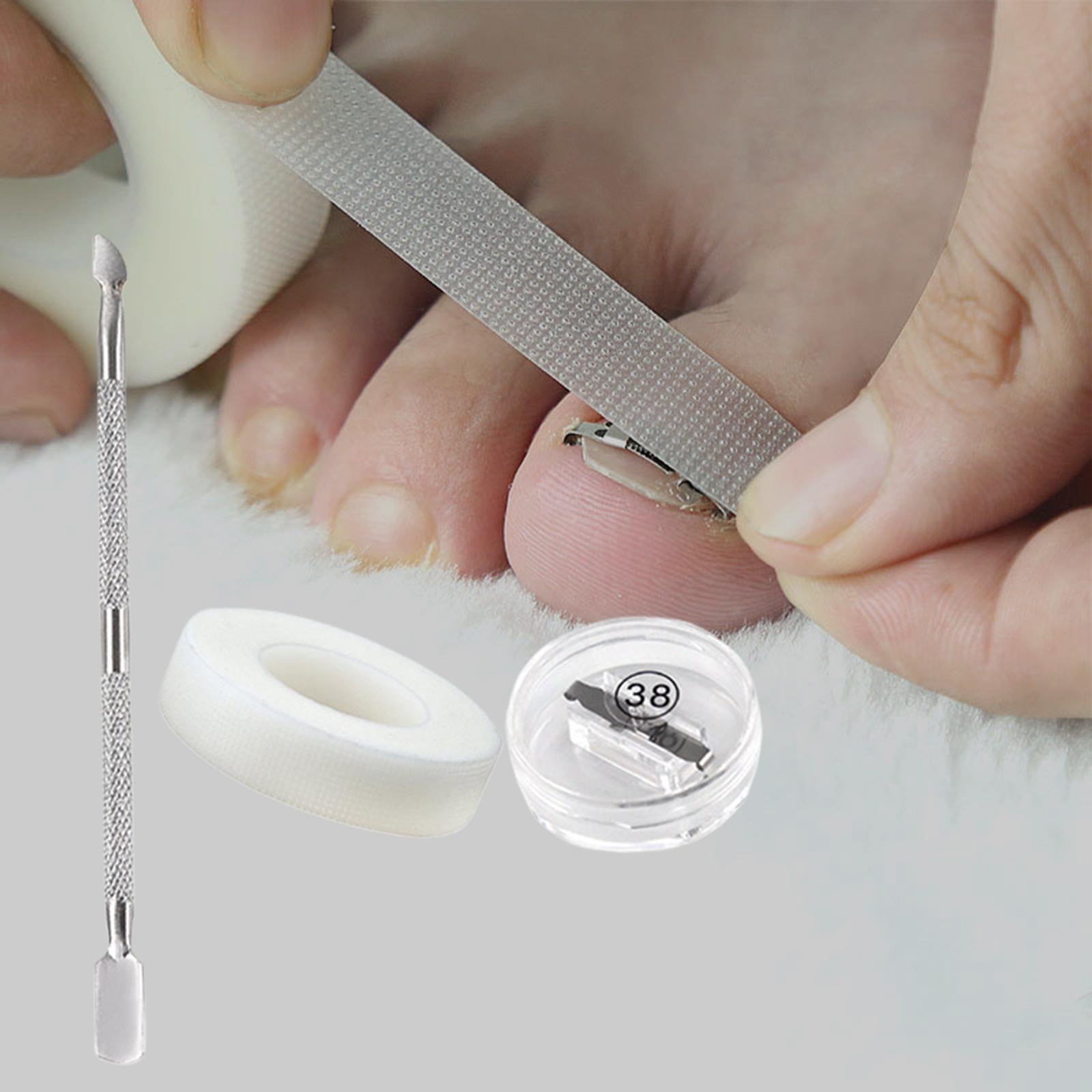 Ingrown Toenail Correction Tool Stainless Steel Reusable Foot Care 38