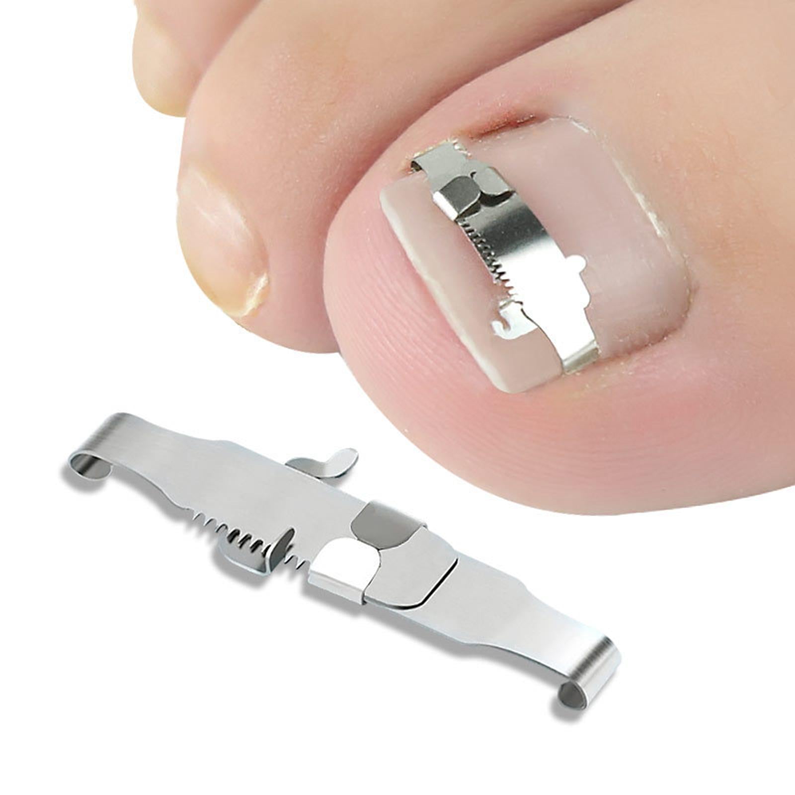 Ingrown Toenail Correction Tool Stainless Steel Reusable Foot Care 40