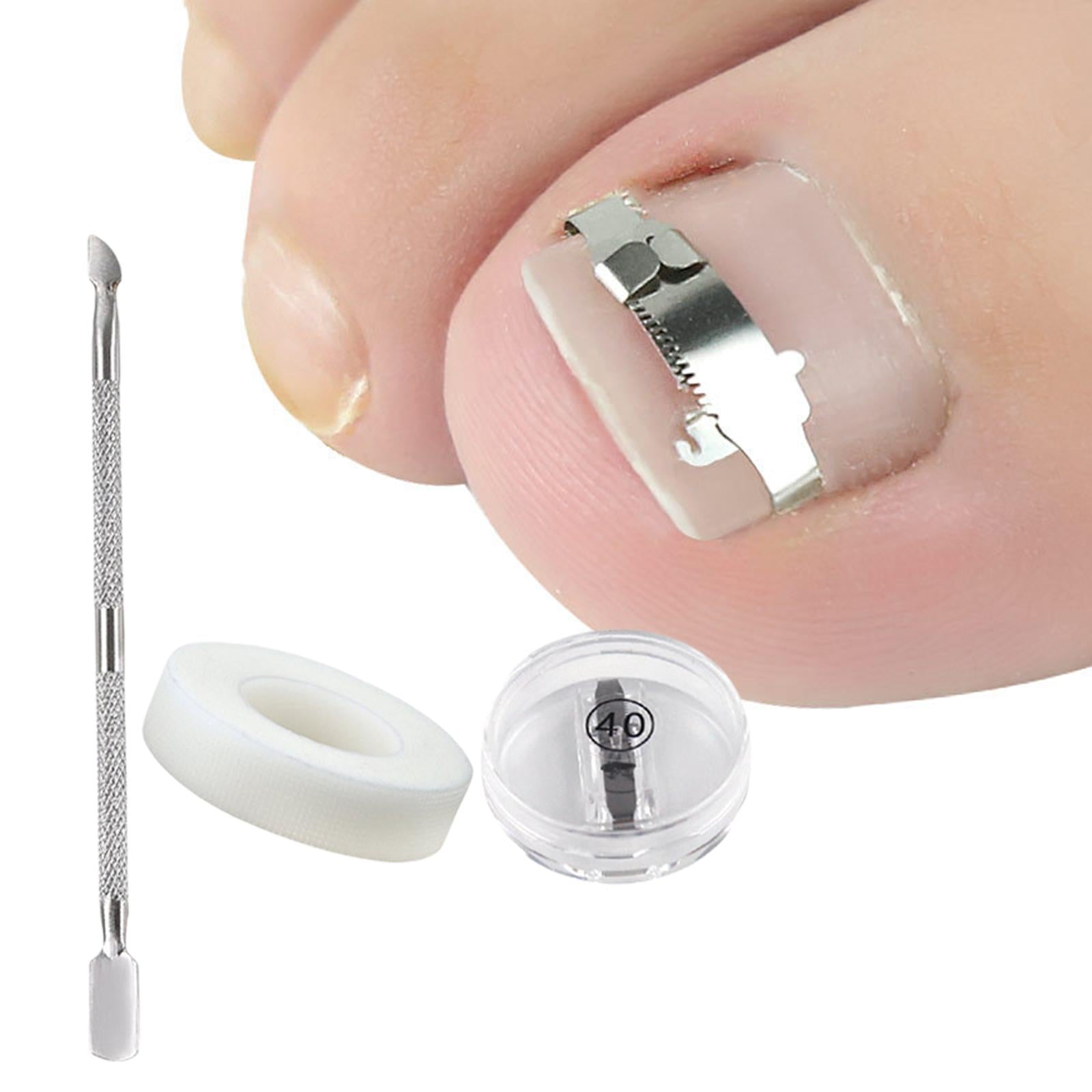 Ingrown Toenail Correction Tool Stainless Steel Reusable Foot Care 40