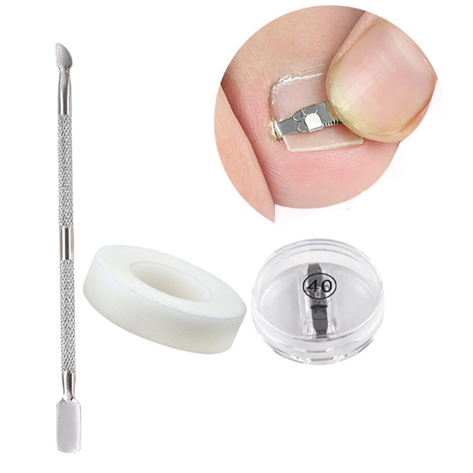 Ingrown Toenail Correction Tool Stainless Steel Reusable Foot Care 40