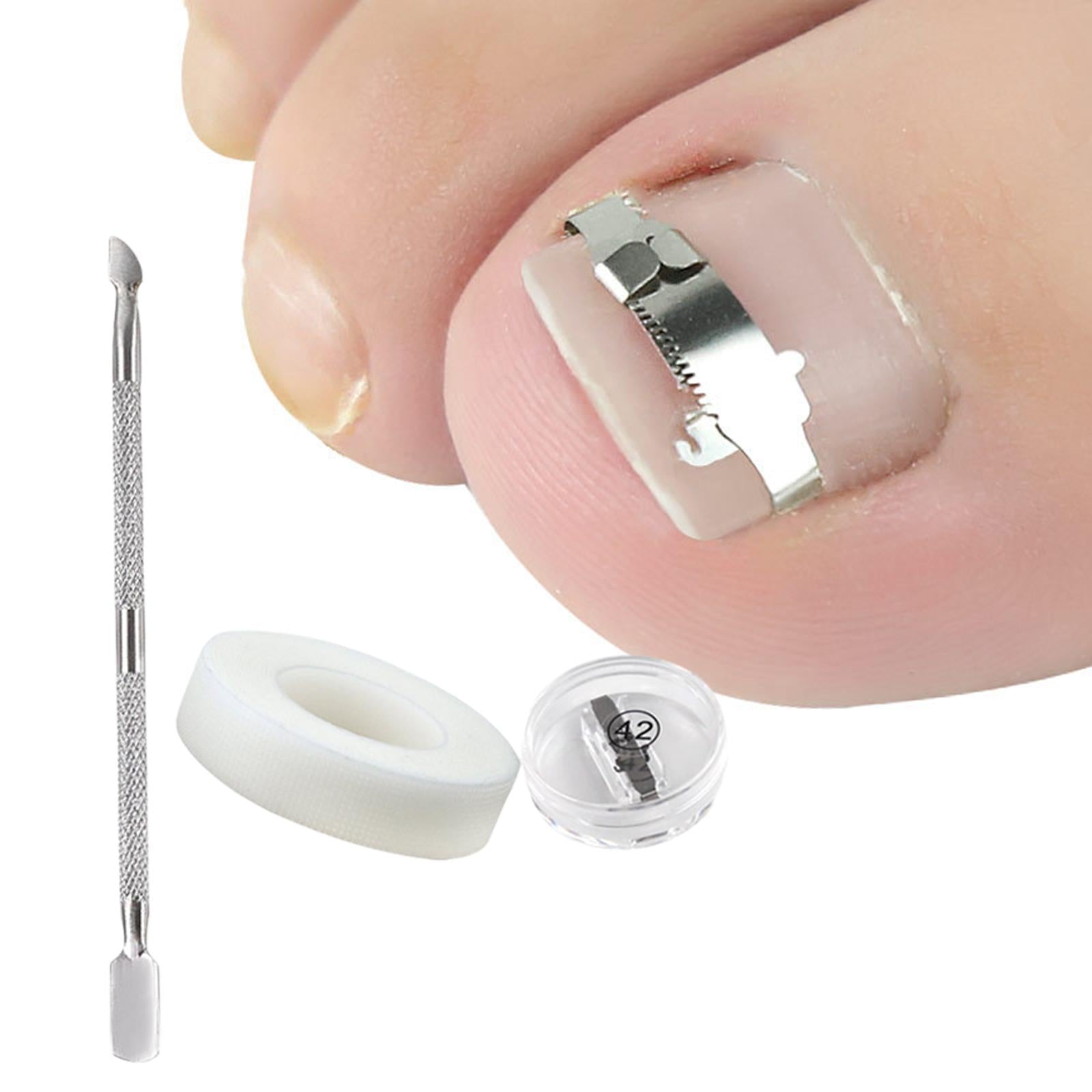 Ingrown Toenail Correction Tool Stainless Steel Reusable Foot Care 42