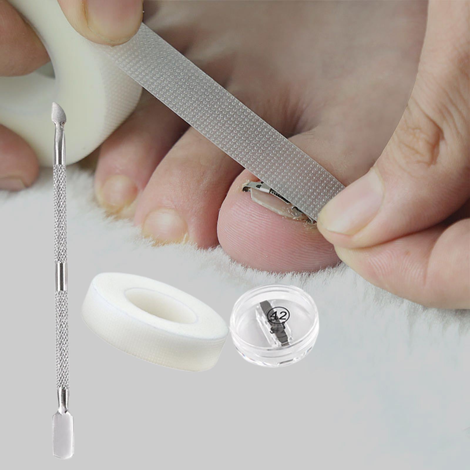 Ingrown Toenail Correction Tool Stainless Steel Reusable Foot Care 42