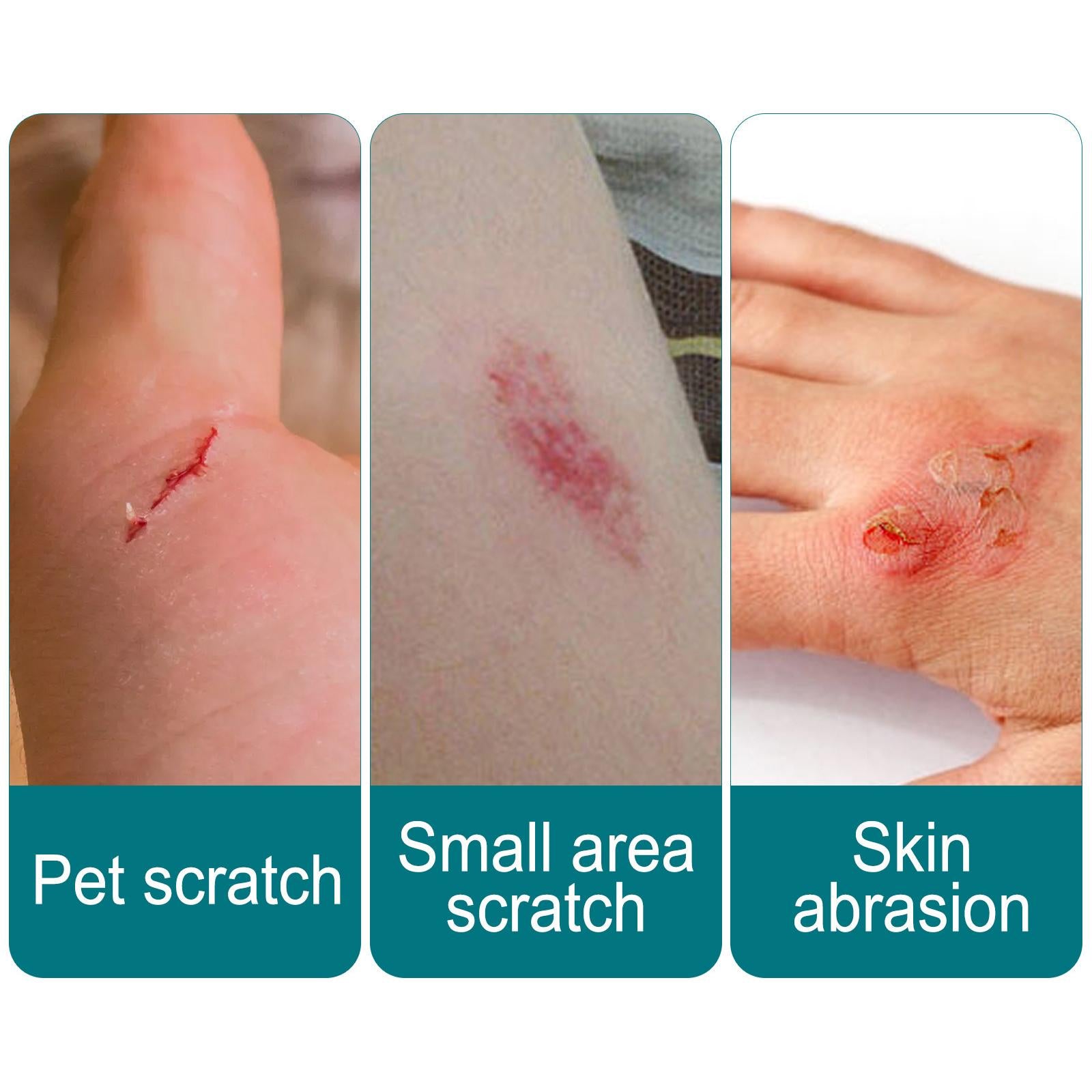 Liquid Skin Bandage Protect Cuts Clear Seals for Injury Wound Minor Cuts