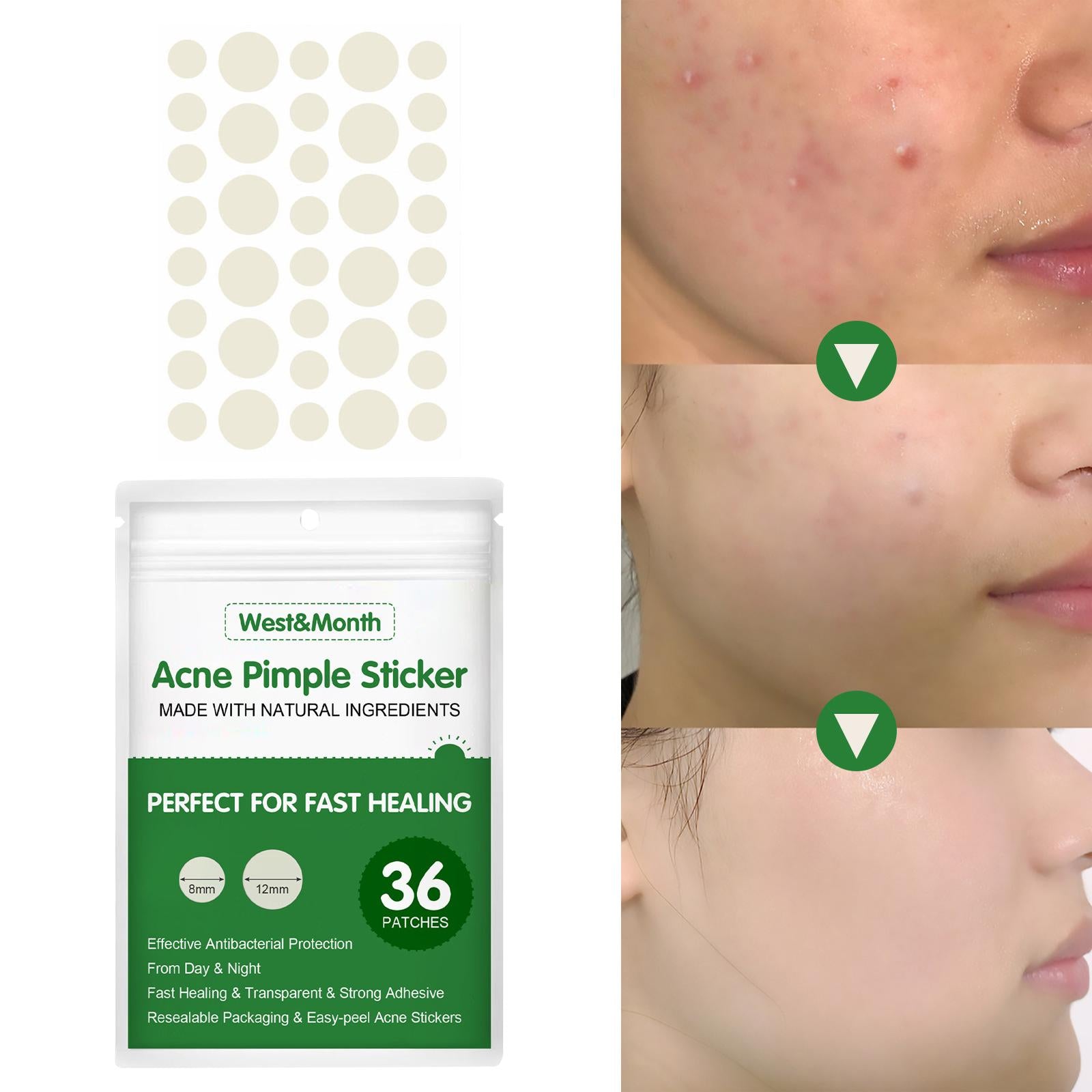 Pimple Acne Treatment Stickers Perfect for Fast Easy-Peel Pack of 36