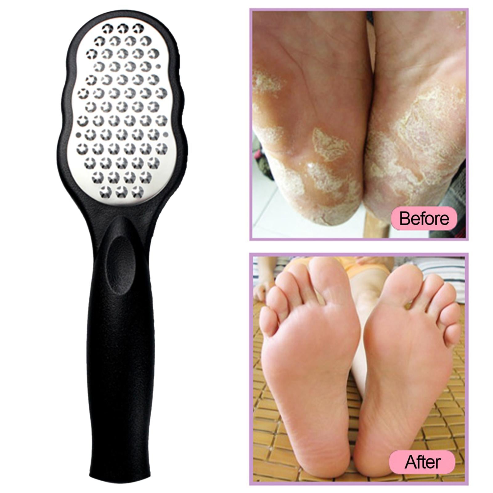 Foot files Stainless Steel Durable for Cracked Heels Trimming Dead Skin Black