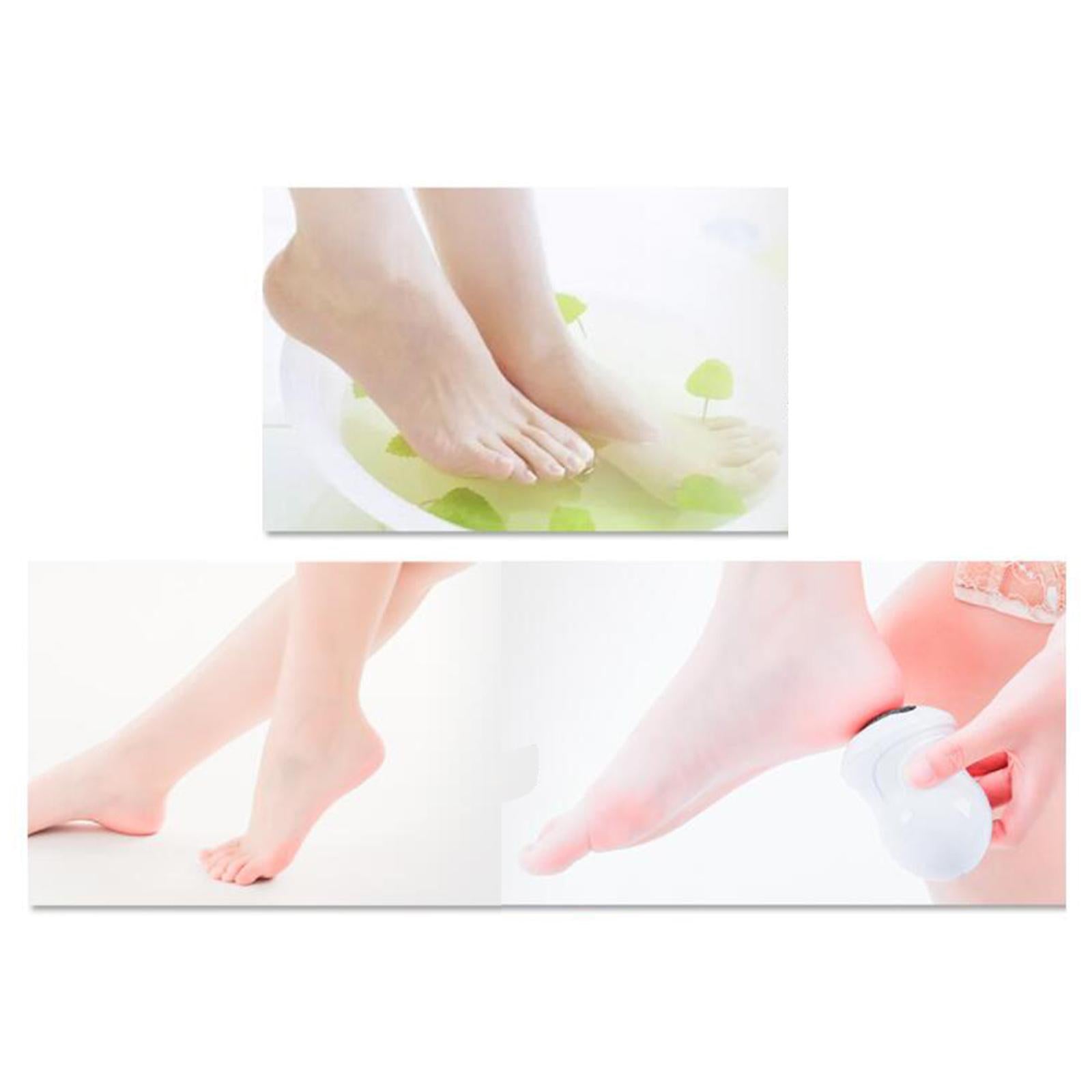 Electric Foot Callus Remover with Vacuum 2 Speed for Feet Care Men & Women