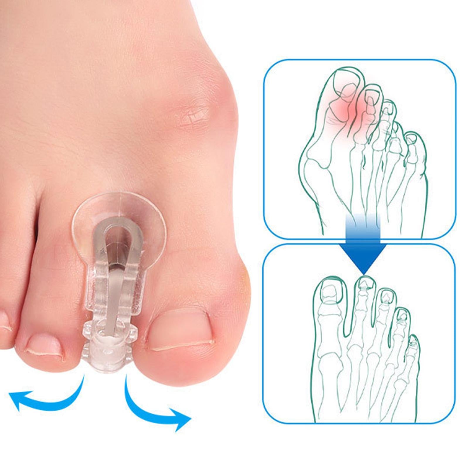 2Pcs Toe Separators Bunions Corrector Spacers Overlapping Toes Bent Toes