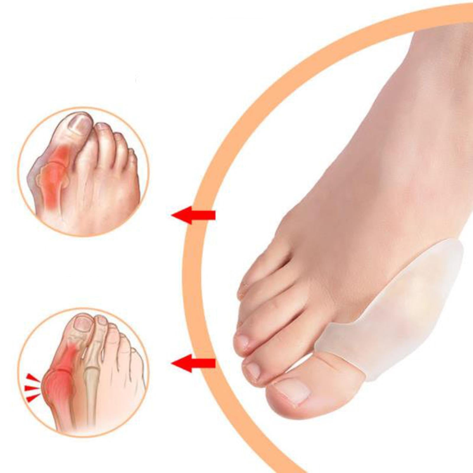 2Pcs Toes Separator for Pain Relief Big Toe Alignment Overlapping Toes