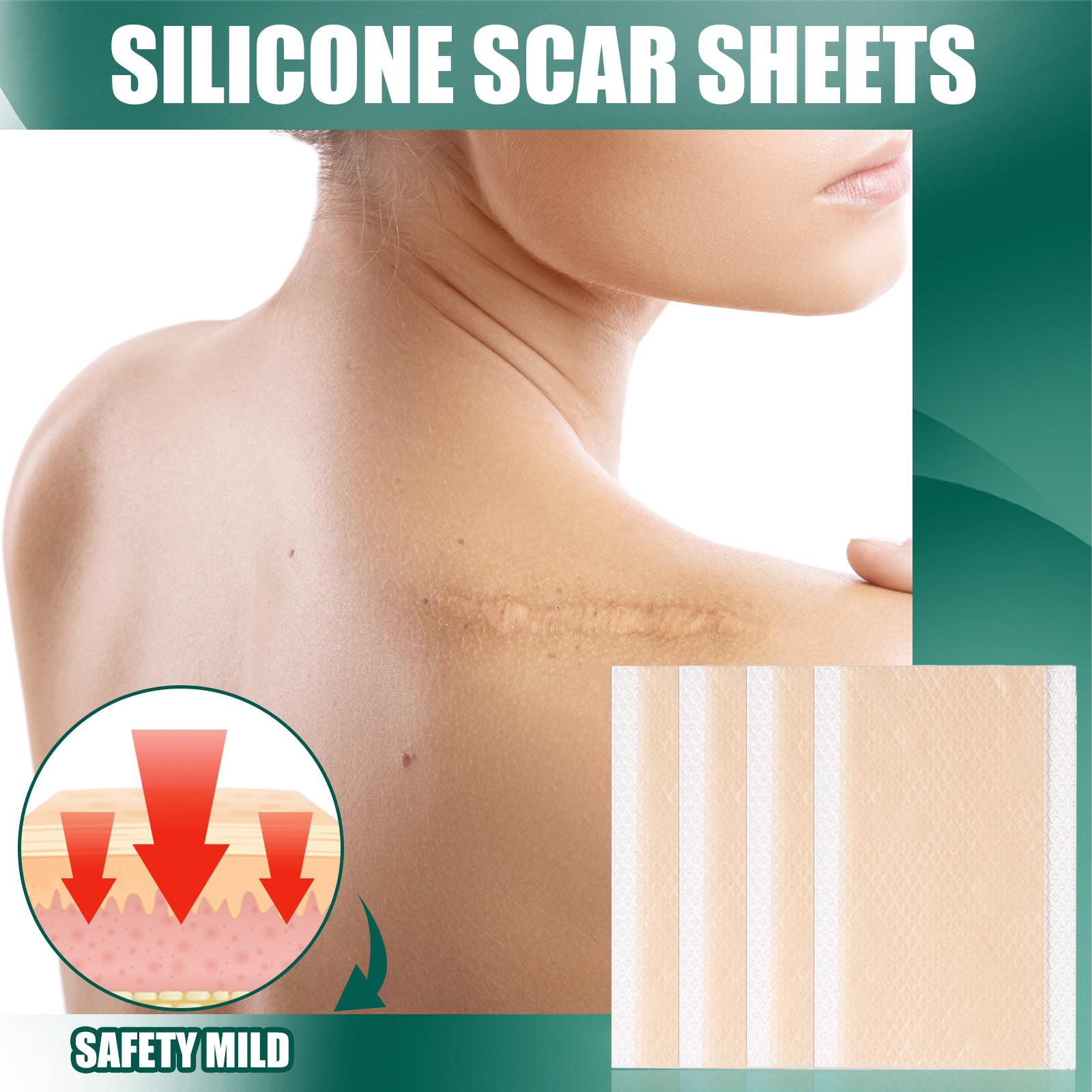 Silicone Scar Removal Sheets Soften Old and New Scars Soft 7.5x4cm