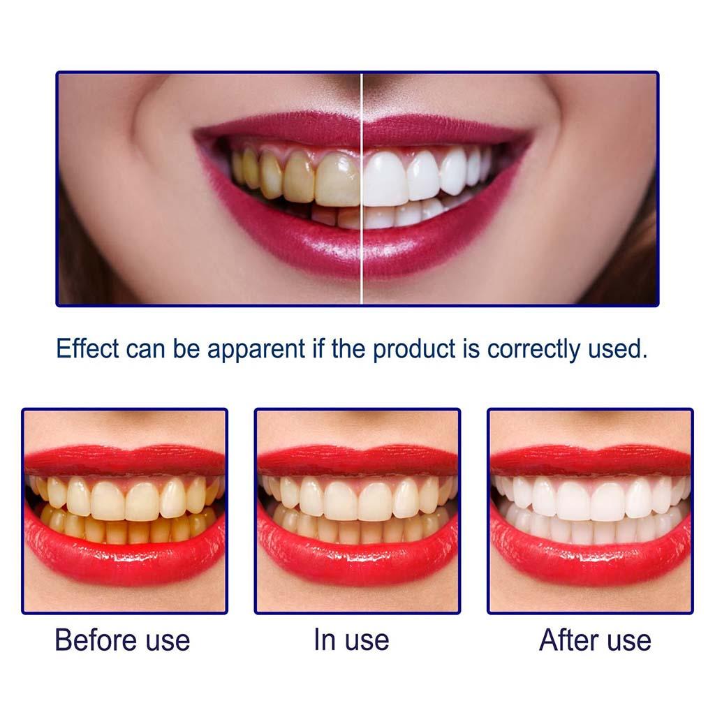 Teeth Whitening Essence Whiten Tooth Cleaning Care Tools for Travel Friendly