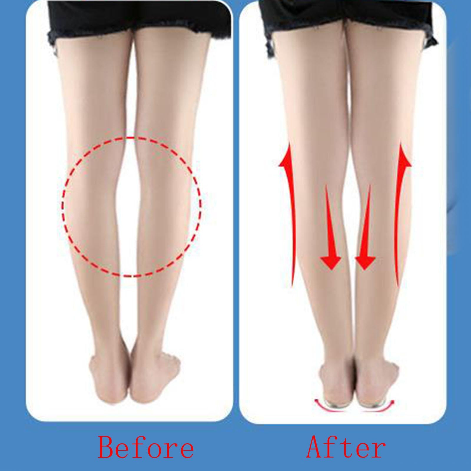 Orthopedic Insoles with Magnets Halfsphere Design for Men Women M Size