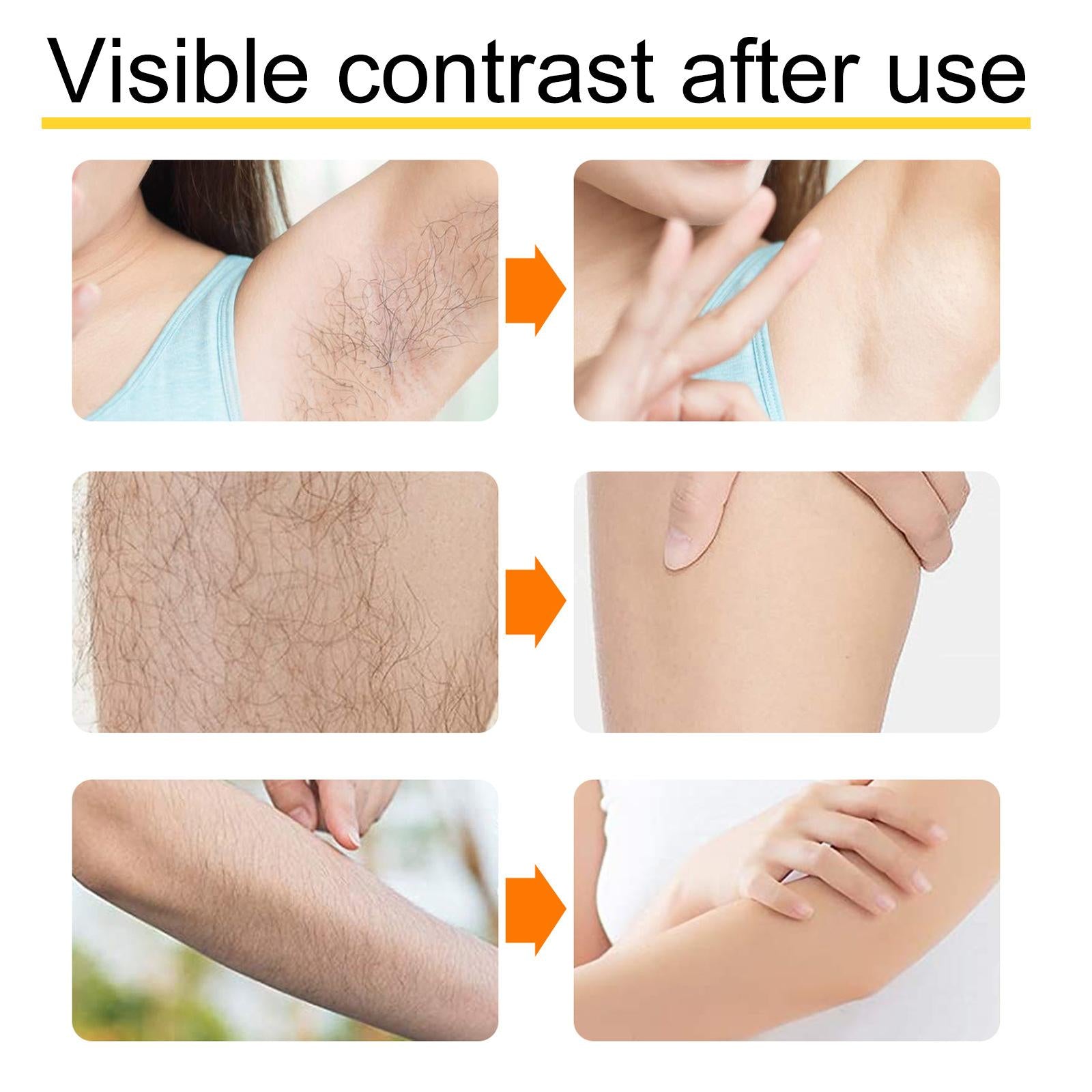 Hair Removal Cream Quick Painless Portable for Underarms Chest Men Women