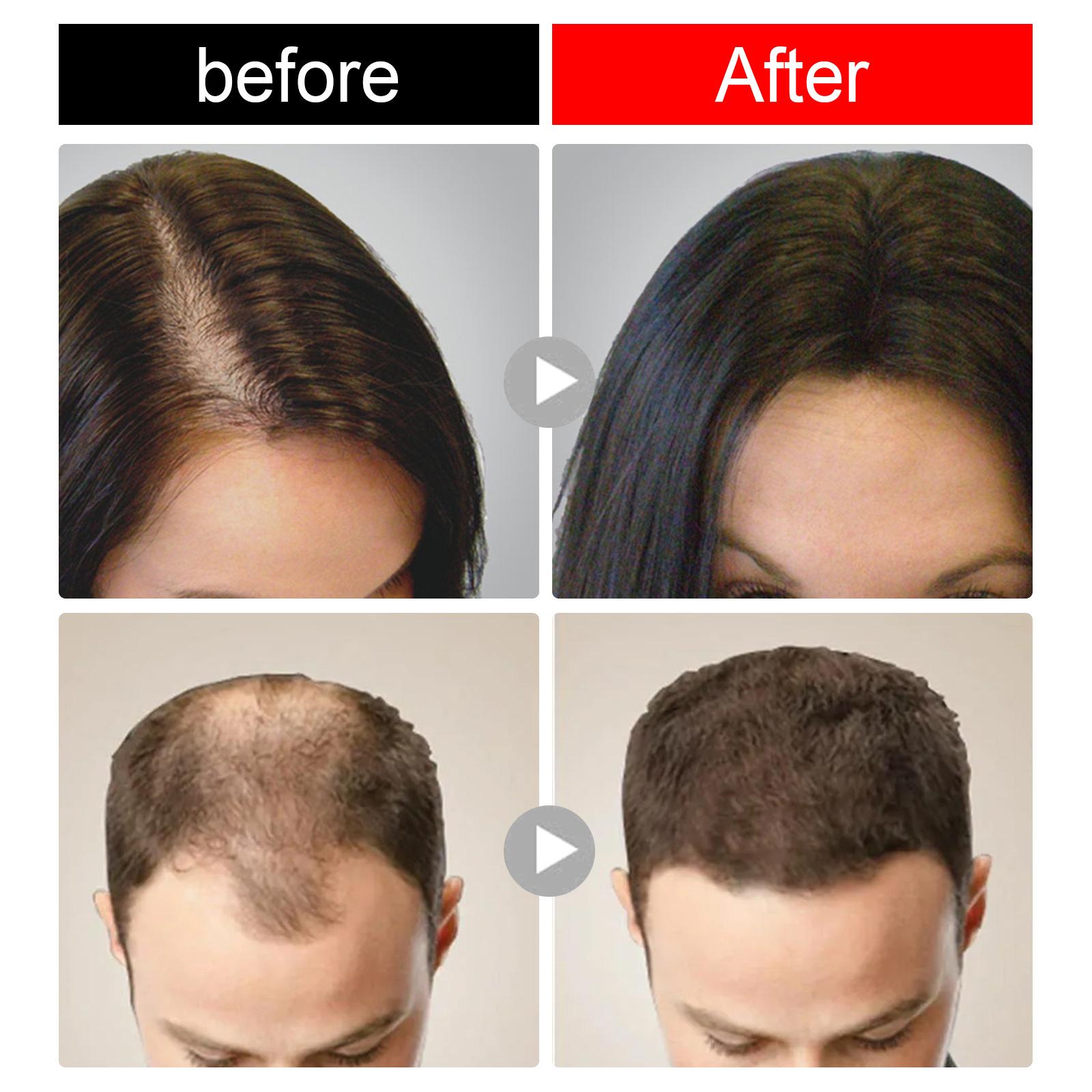 Rice Shampoo Bar Moisturizing Nourishhair Anti Hair Loss, for Women Lady