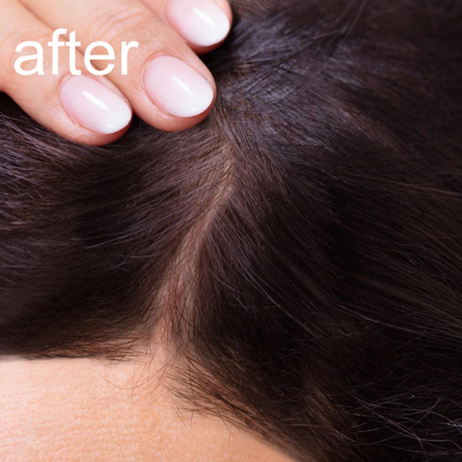 Rice Shampoo Bar Moisturizing Nourishhair Anti Hair Loss, for Women Lady