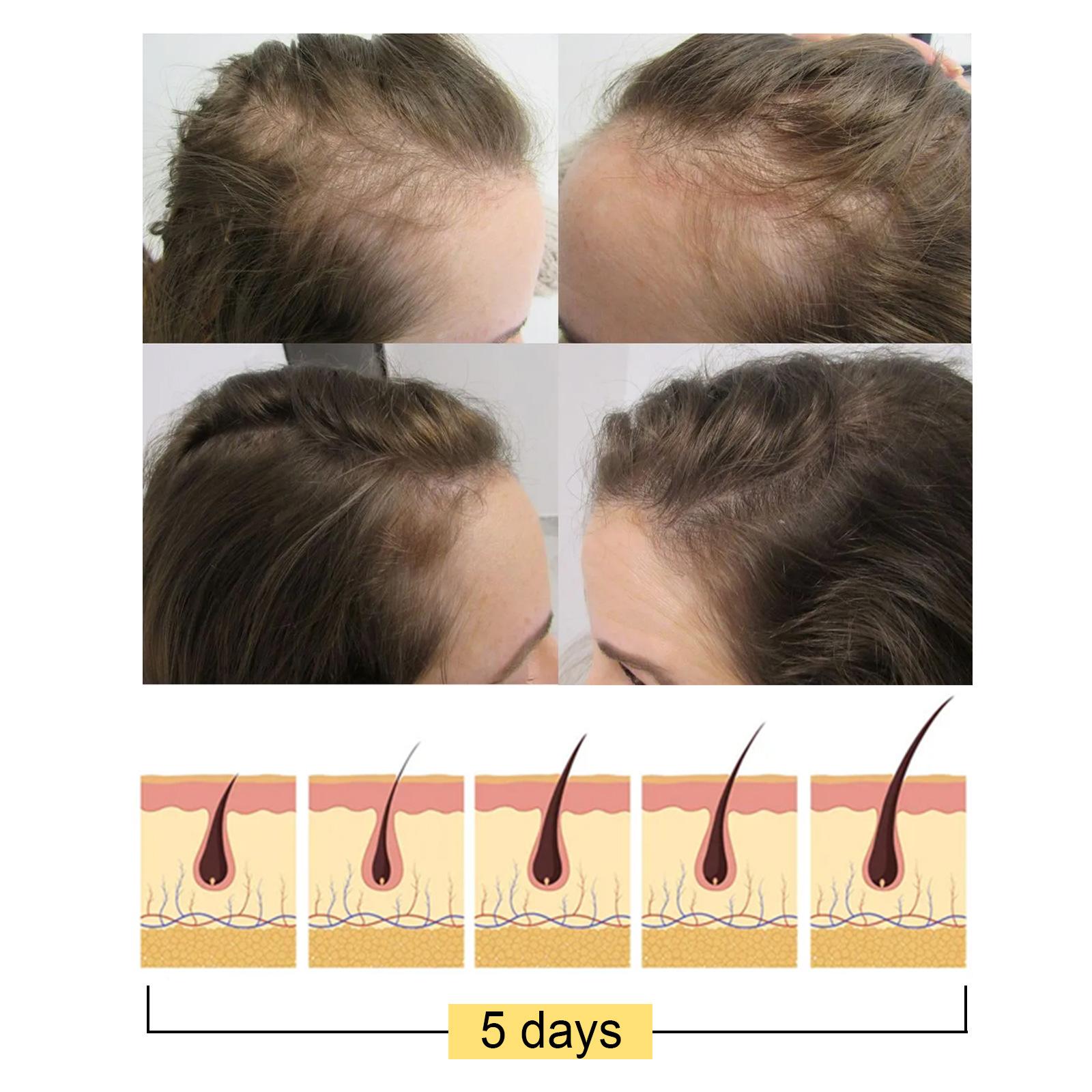 Rice Shampoo Bar Moisturizing Nourishhair Anti Hair Loss, for Women Lady