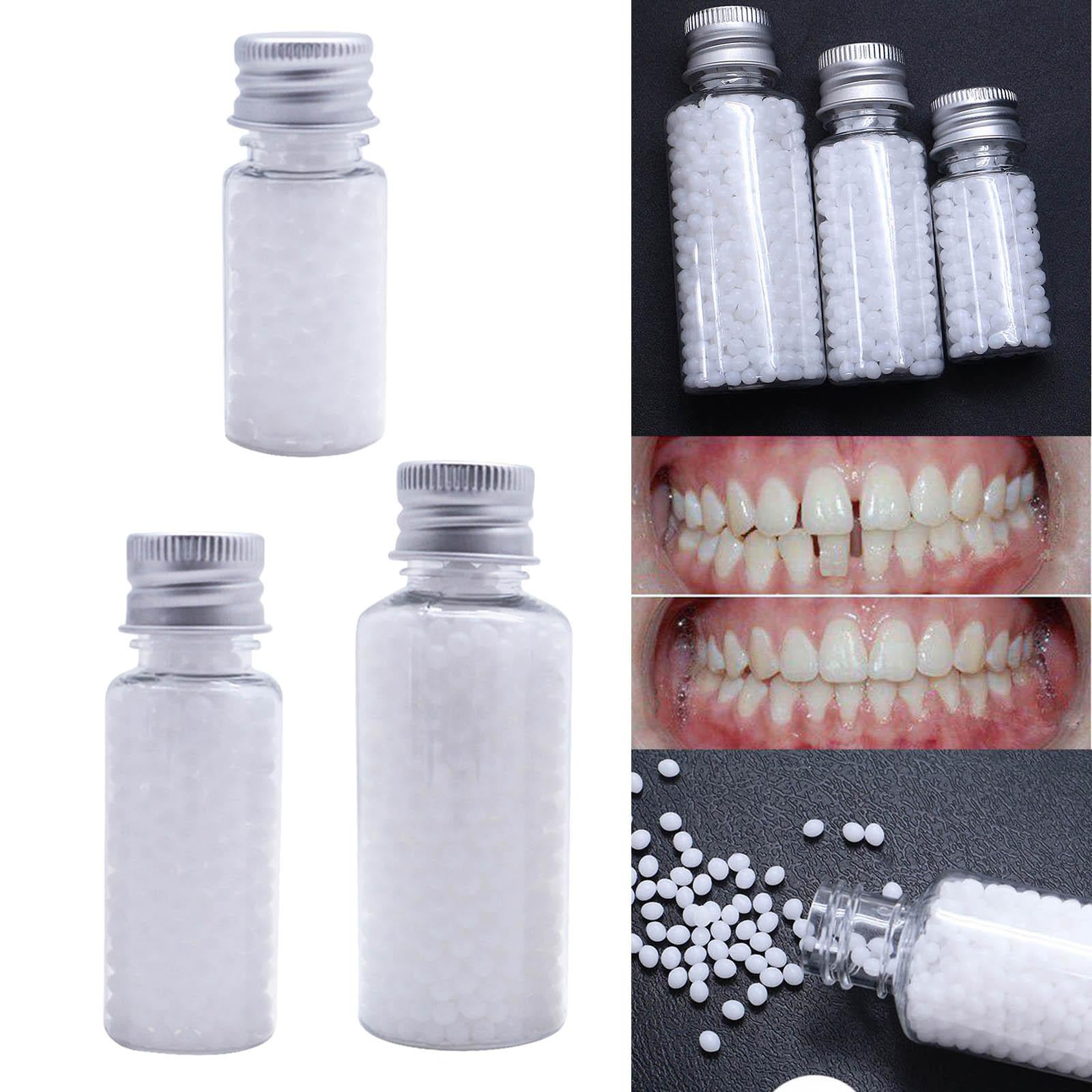 Thermal Beads Teeth Veneers Moldable for Broken Teeth Uneven Teeth 10g