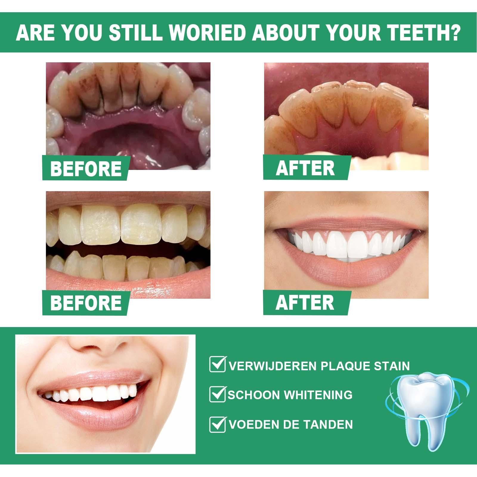 Organic 50G Teeth Whitening Powder Brightening Oral Cleaning Oral Care