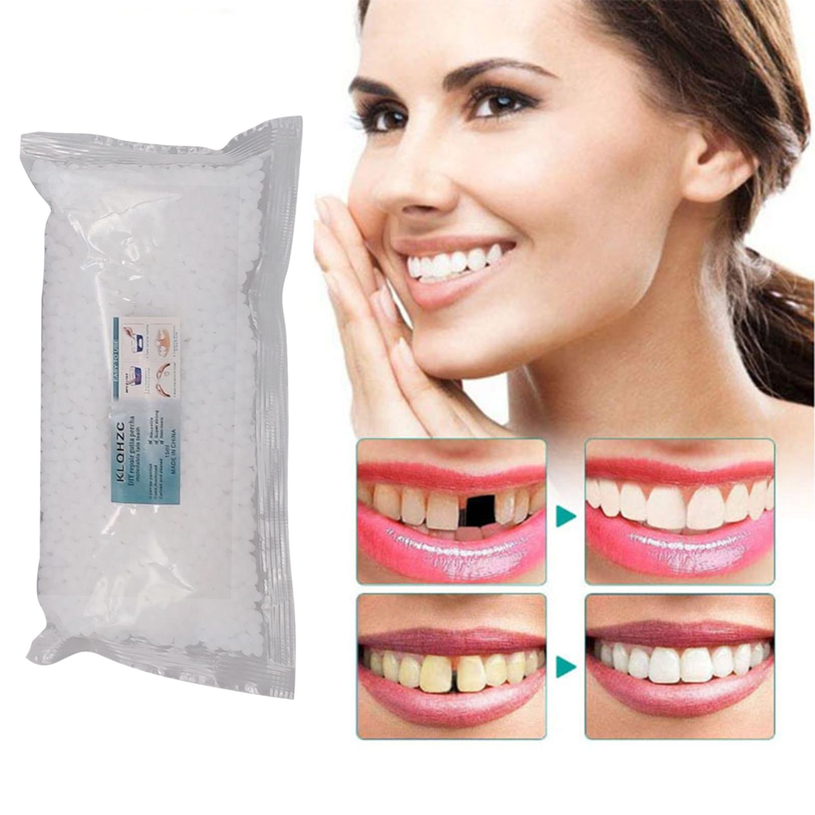Temporary Tooth Repair Kit 100G Repair Granules Teeth Replacement Kit Safe