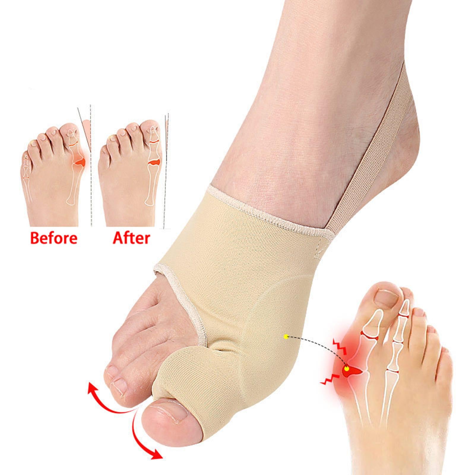 Bunion Corrector Kit Improves Toe Realignment Hallux Valgus Relief Non Slip Normal Skin L