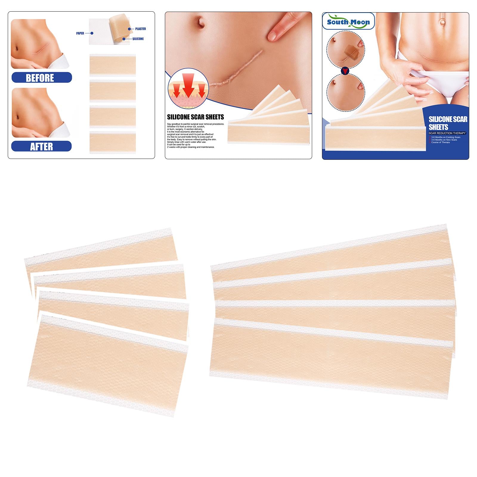 4x Silicone Scar Sheets Strips for Tummy Tuck C Section New and Old Scars 4x15cm