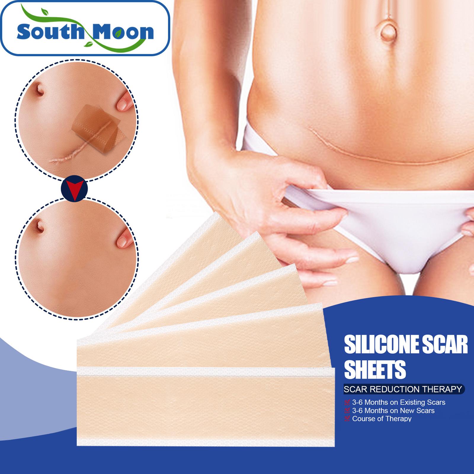 4x Silicone Scar Sheets Strips for Tummy Tuck C Section New and Old Scars 4x7.5cm