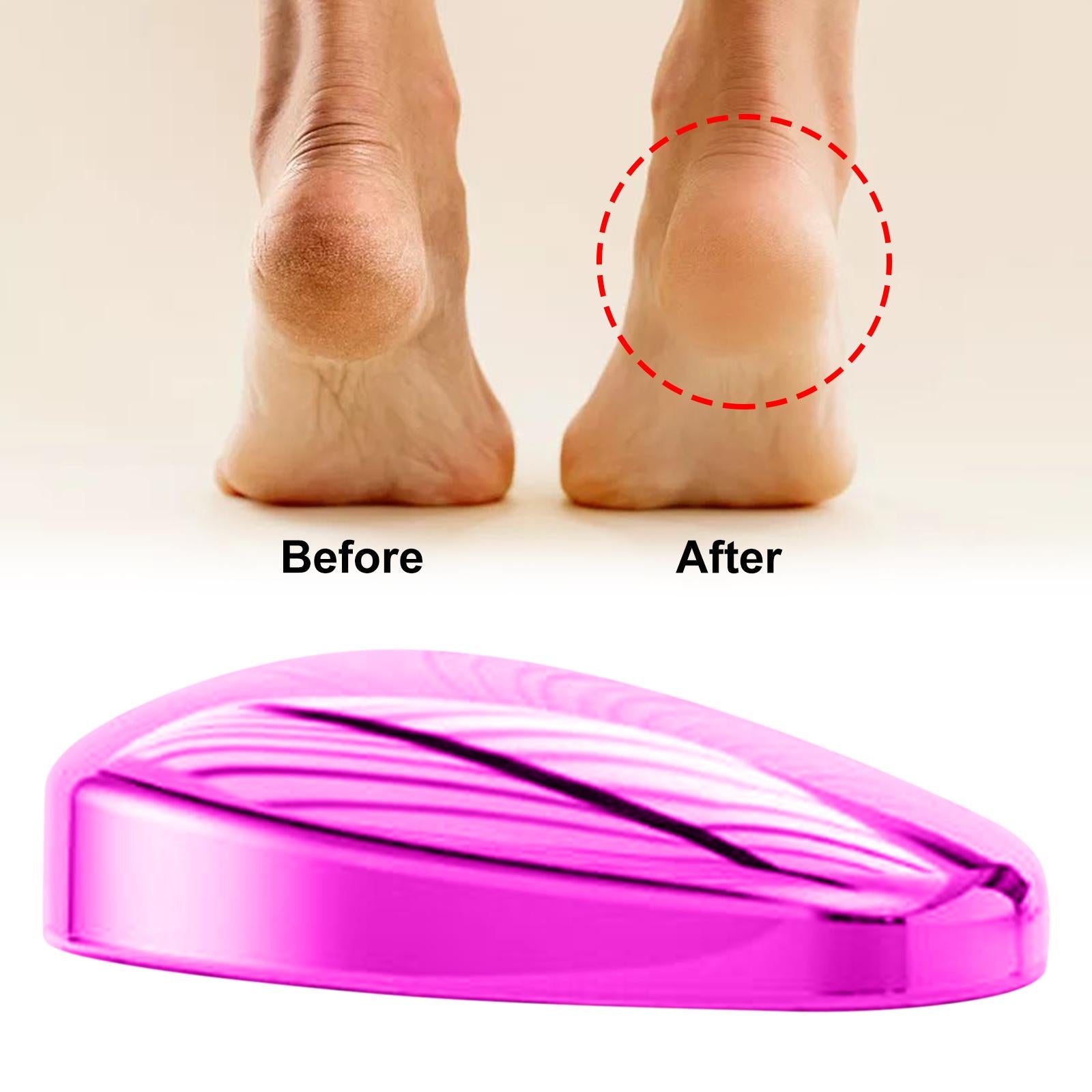 Manual Foot Callus Remover Feet Files for Dead Hard Skin Men Women Purple