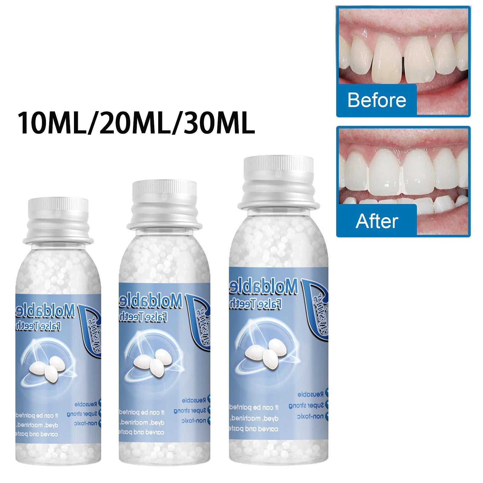 Temporary Tooth Repair Kit Denture Adhesive Teeth Gaps for Broken Big Gaps 10ml