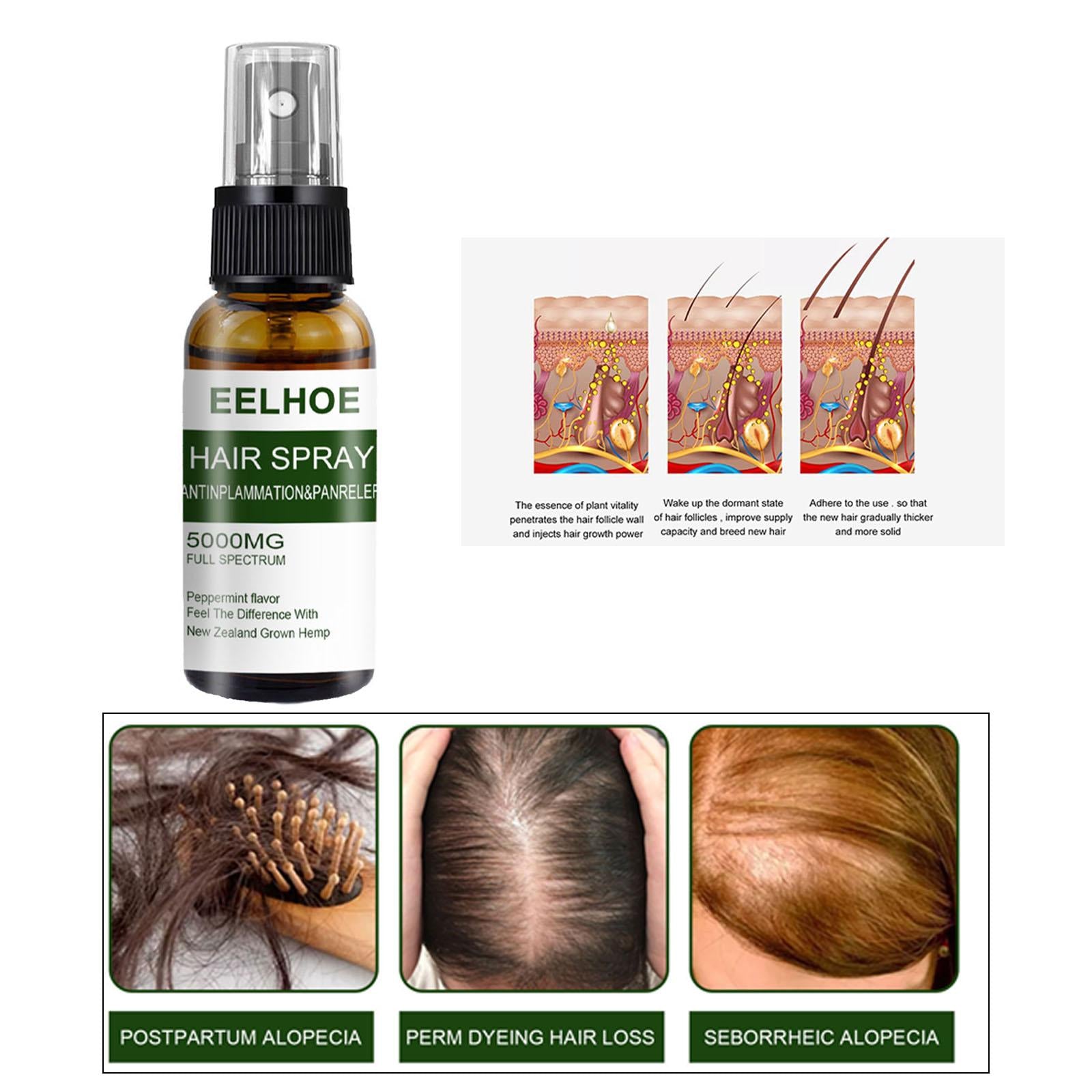 50ml Hair Growth Spray for Thinning Different Hair Types