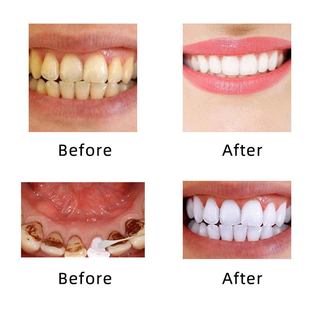 3x10ml Teeth Whitening Water Oral Hygiene Cleaning Teeth Care Tooth Cleansing