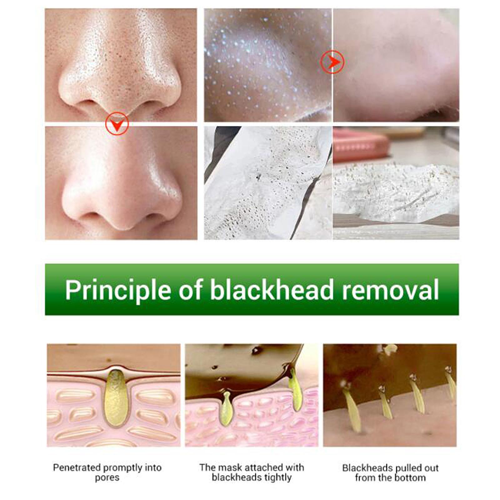 4x160pcs   nose pore strips papers 