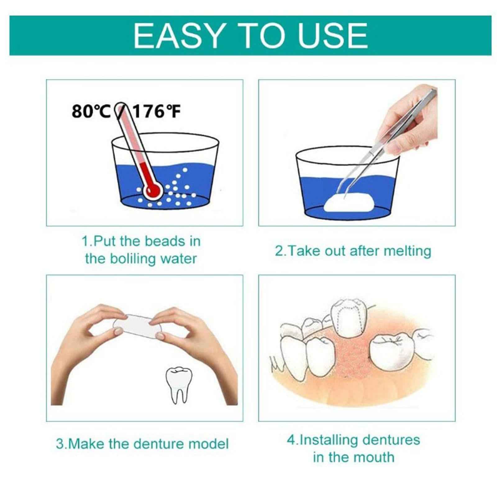 Thermal Beads Teeth Veneer Moldable Denture Temporary Tooth Repair Tool 5g