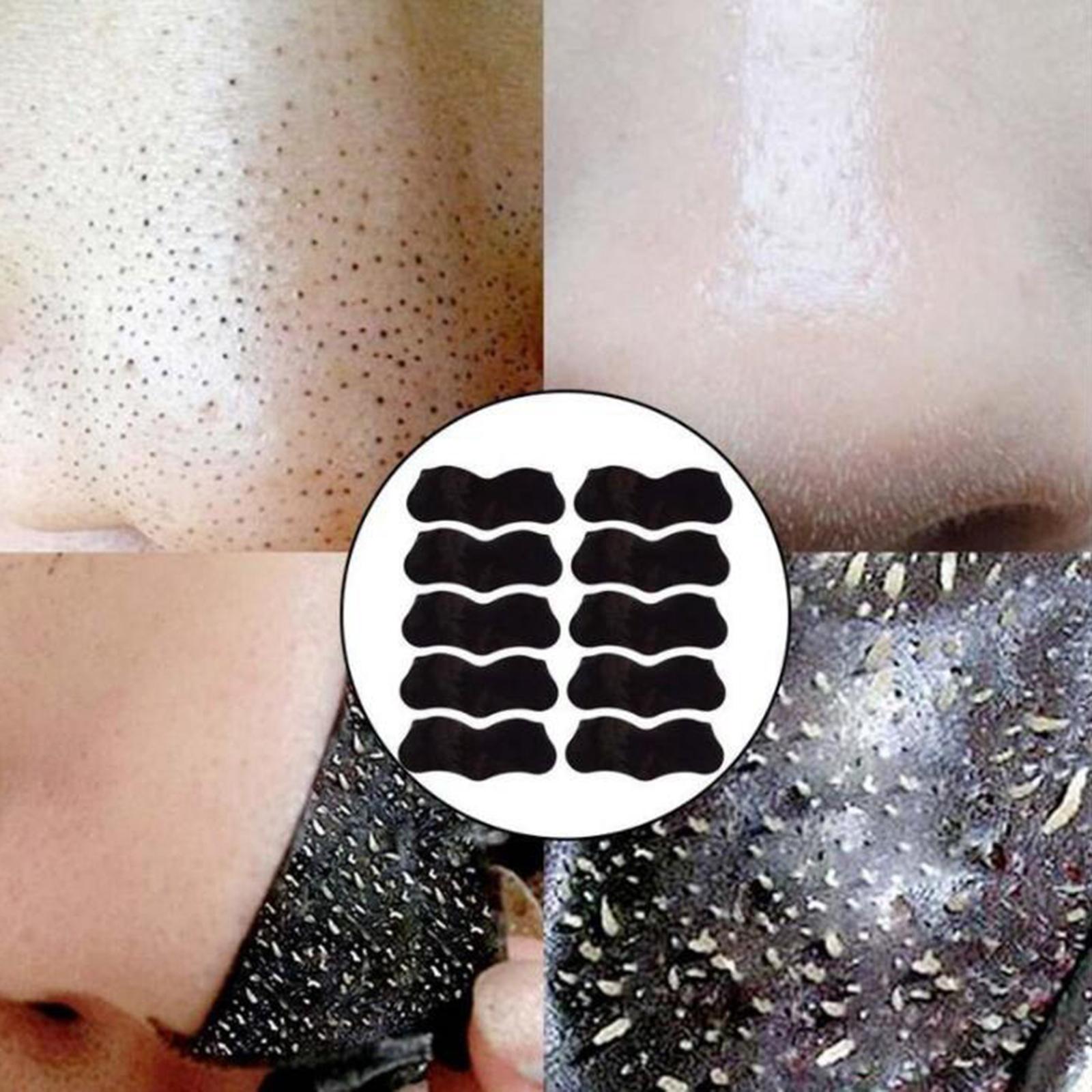 3xBlackhead Remover Peel Off Nose Strips Pore Cleaner Acne Treatments 10 Pcs