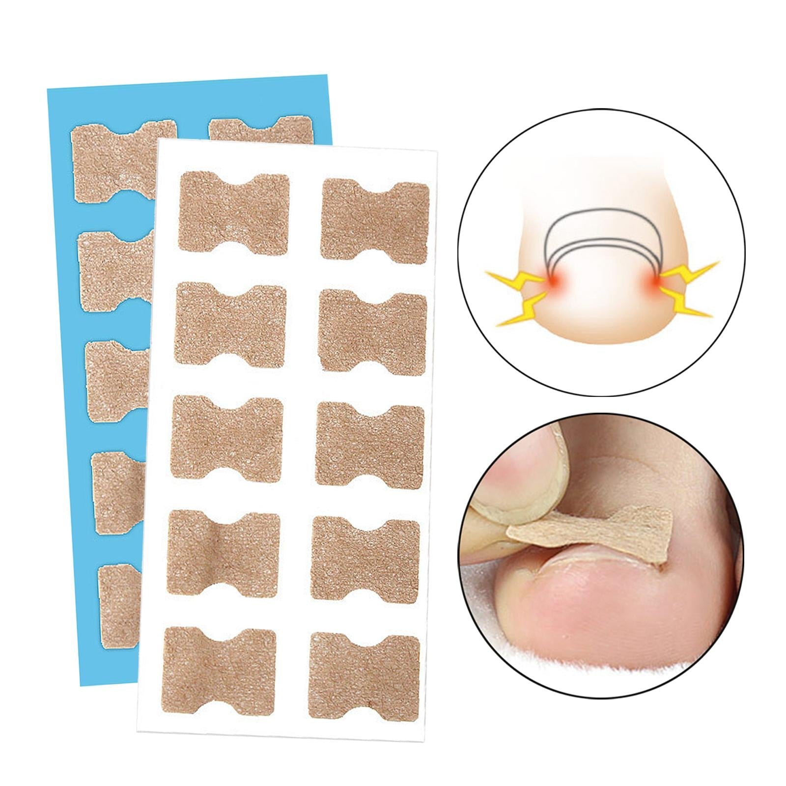 100x Ingrown Toenail Corrector Stickers Toenail Patch for Pedicure Tools White