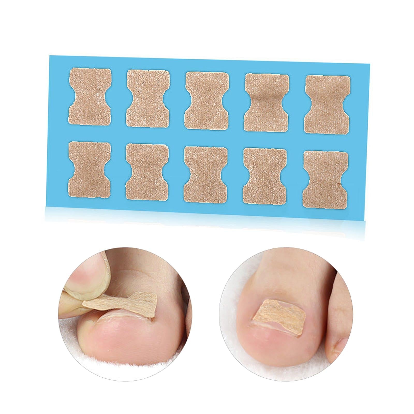 100x Ingrown Toenail Corrector Stickers Toenail Patch for Pedicure Tools Blue