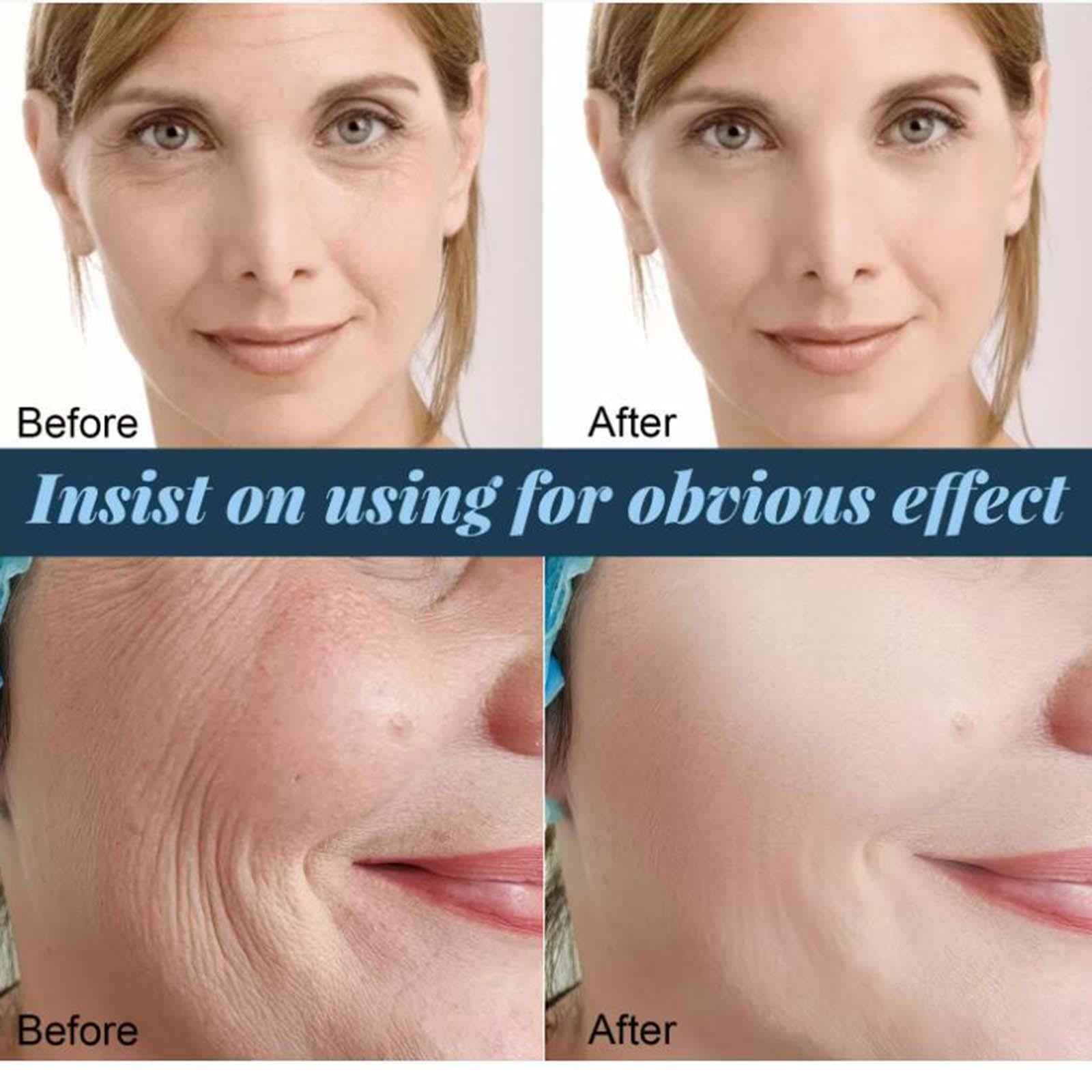60x Face Protein Threads Wrinkle Firming Collagen Silk Thread Face Serum