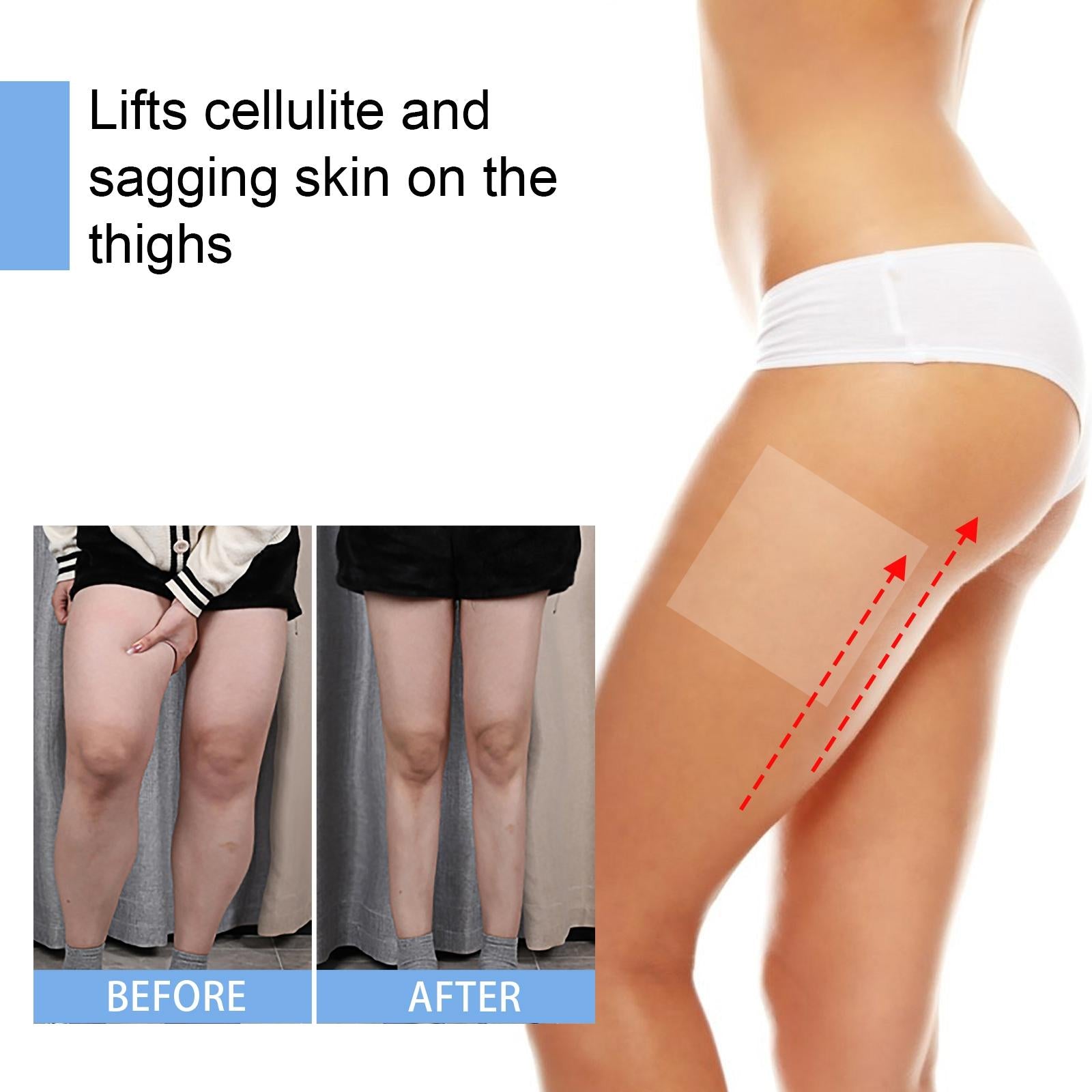 10Pcs Thigh Lift Tape Instantly Lift Smooths Wrinkles Anti Chafing