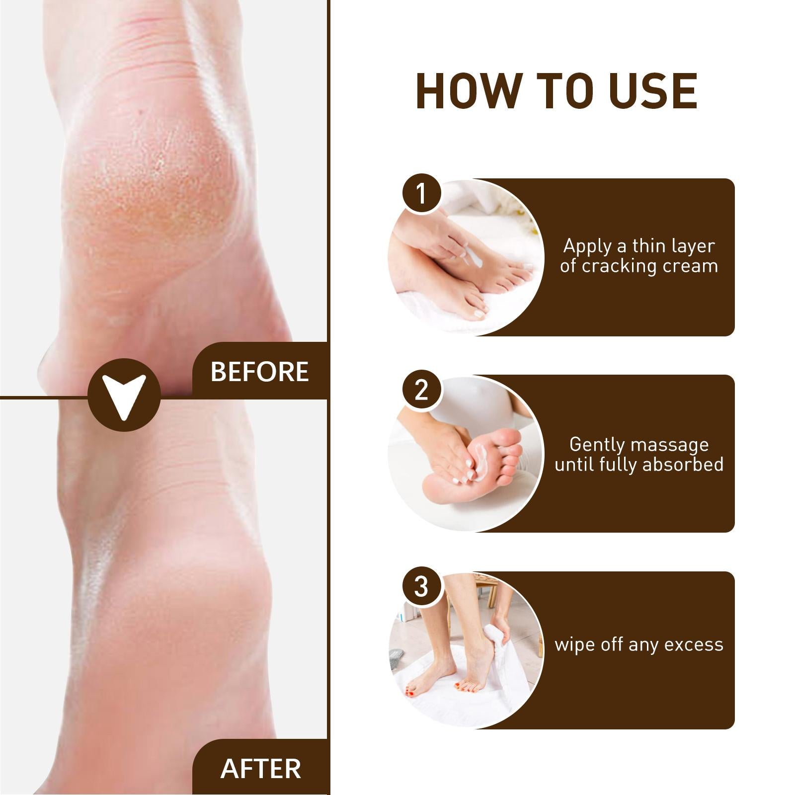 3xCracking Resistance Cream Moisturizing   Cracking Feet Hands
