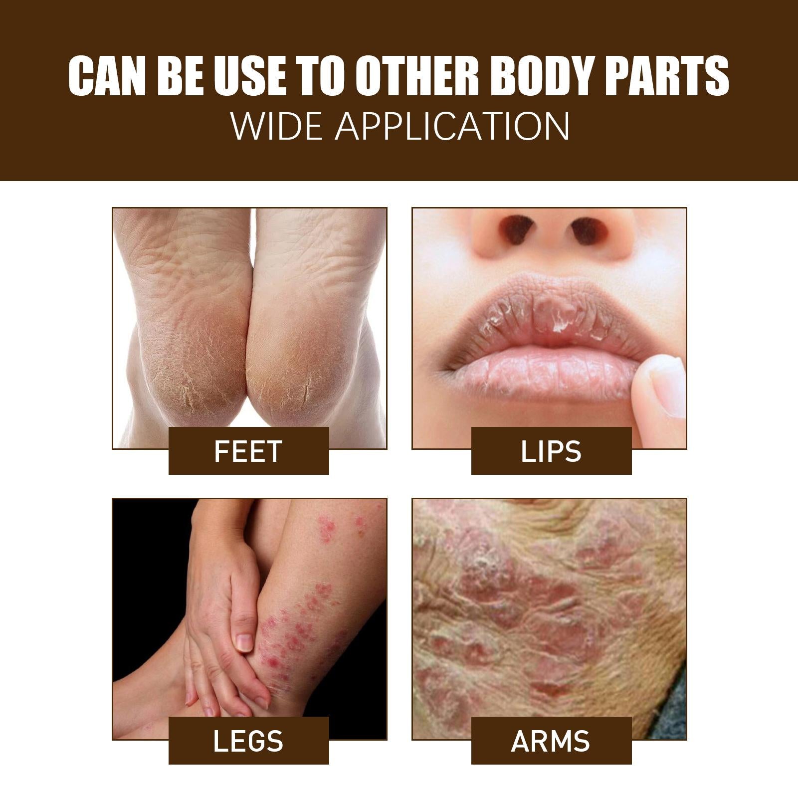 3xCracking Resistance Cream Moisturizing   Cracking Feet Hands