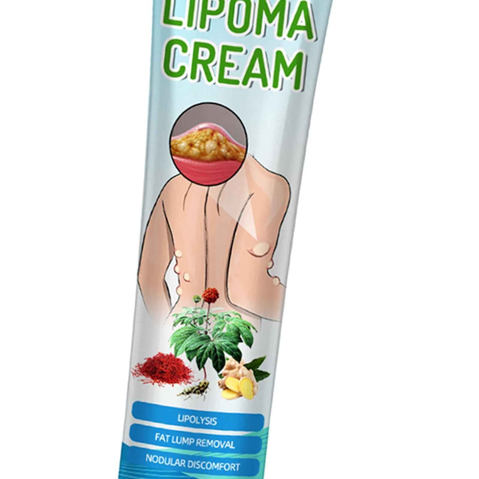 20g Lipoma Removal Cream Mild Easy to Use Care Cream Wide Applaications