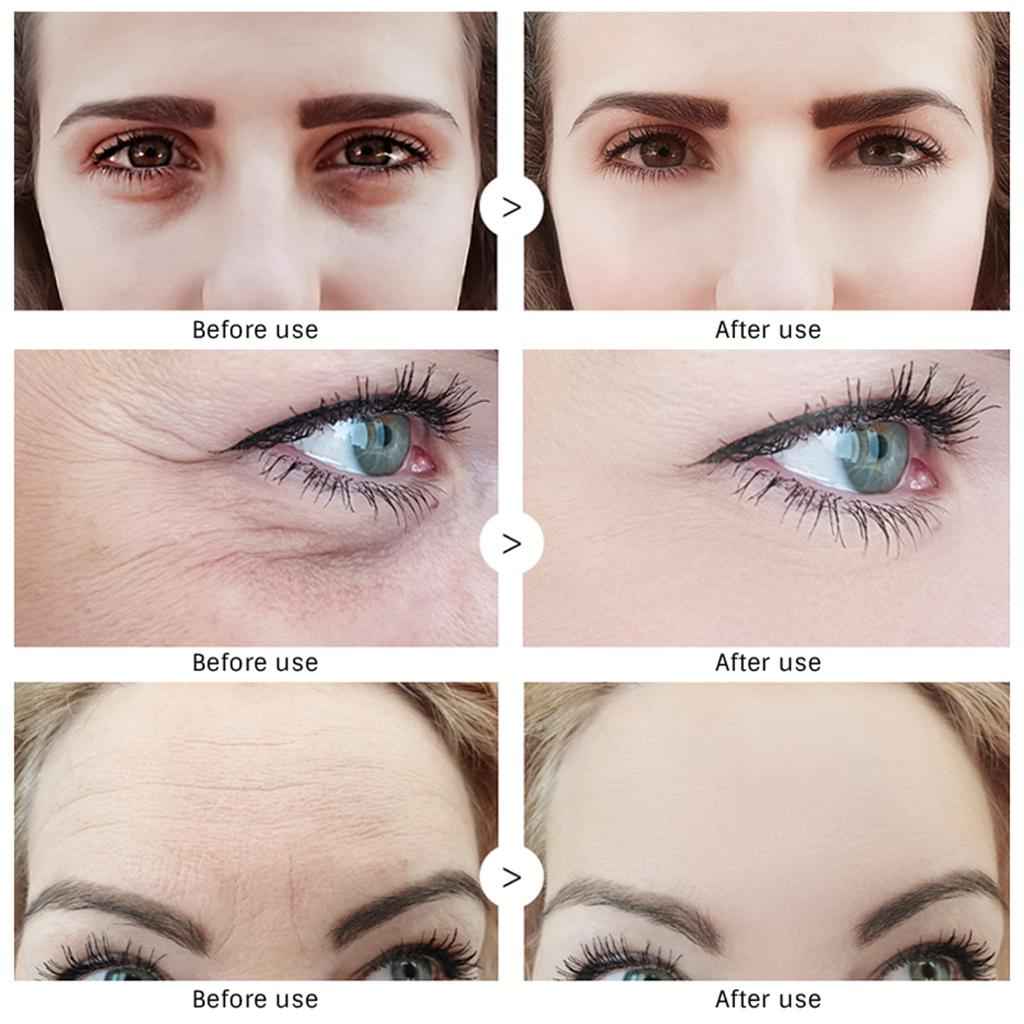 EyeCream Instant Remove Eyebags Firming Eye Anti Puffiness Dark Circles
