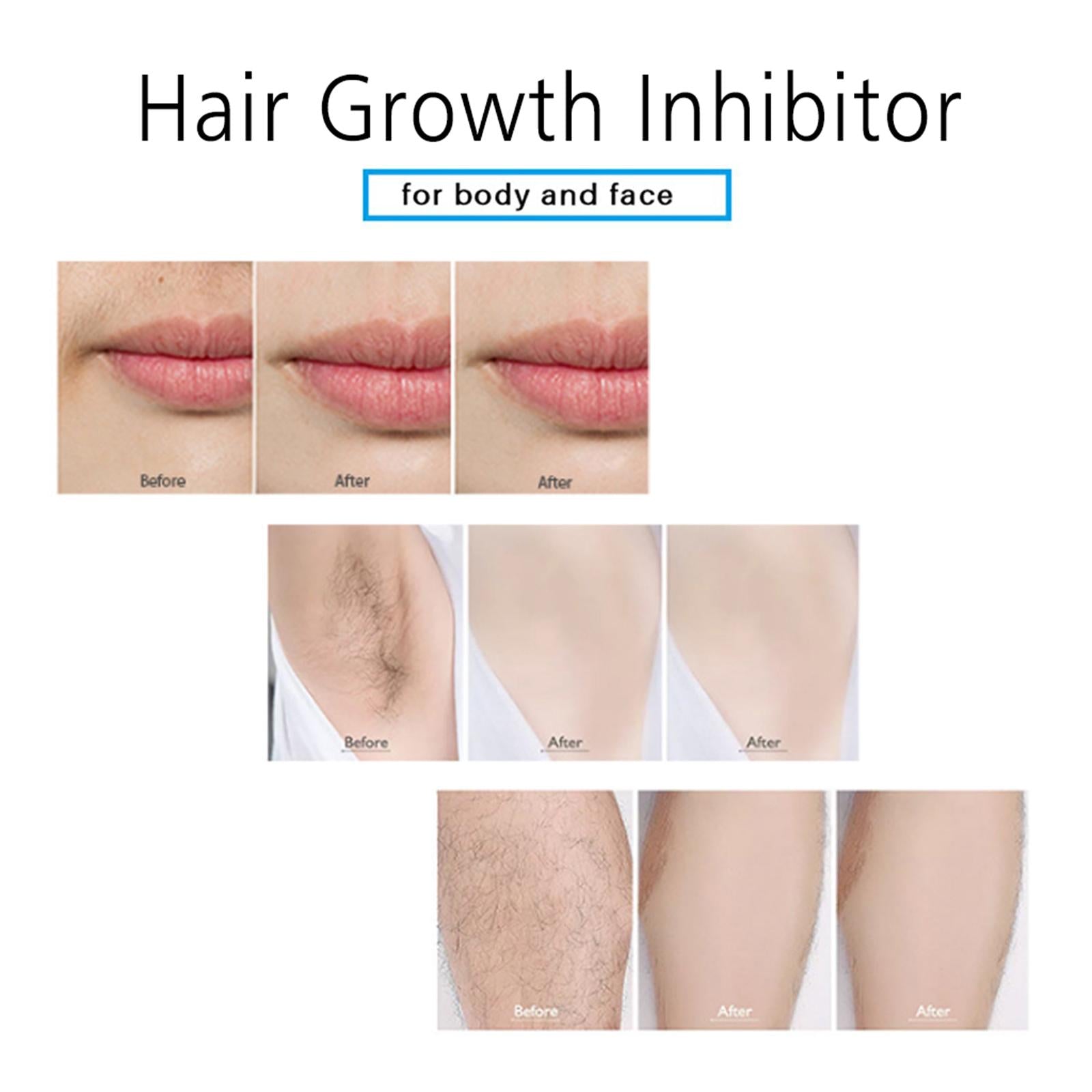 5xPainless Permanent Hair Removal Inhibitor Spray Stop Hair Smooth Women 30ml
