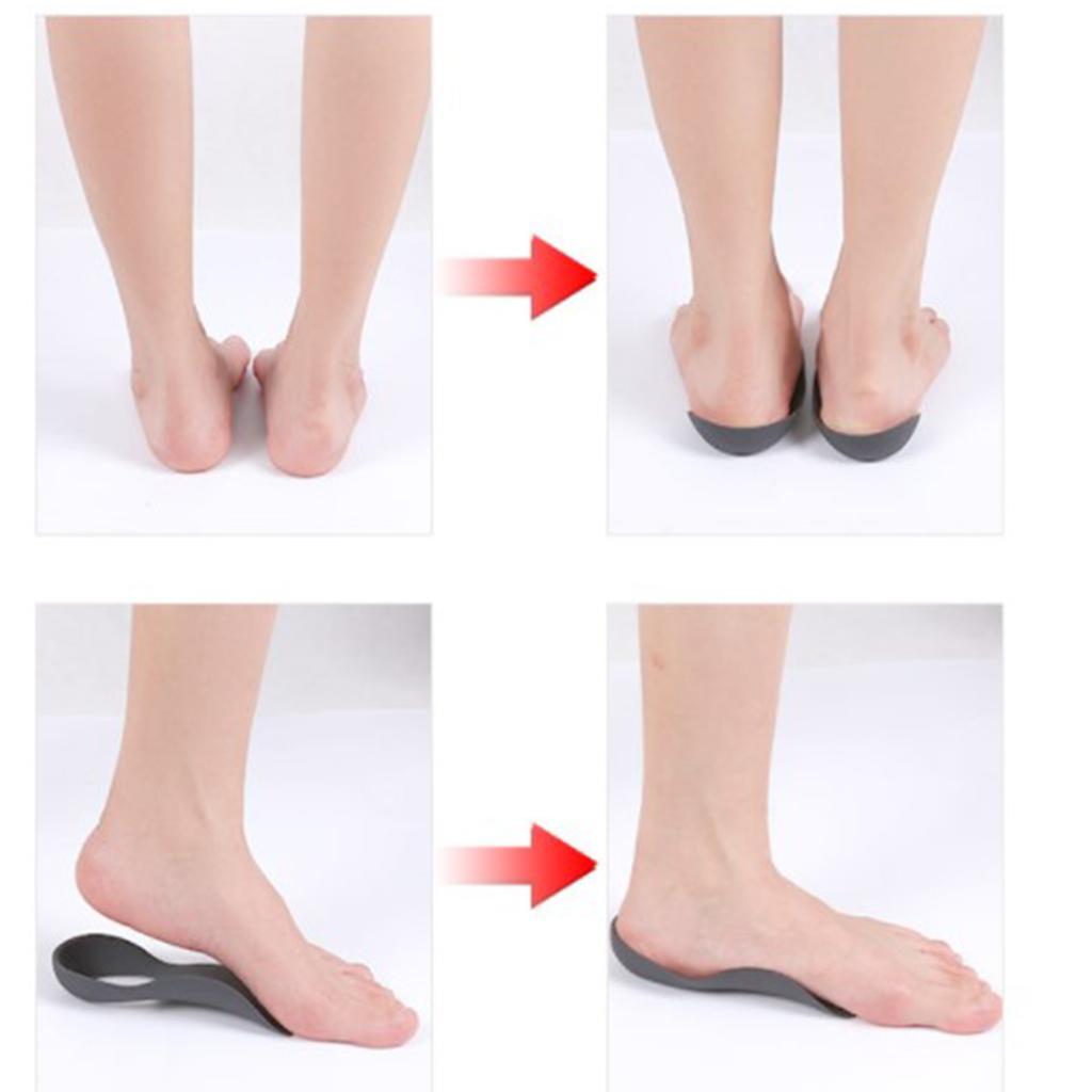 Arch Support Insole Flat Foot Gel Pad Orthopedic Foot Child Women Black L