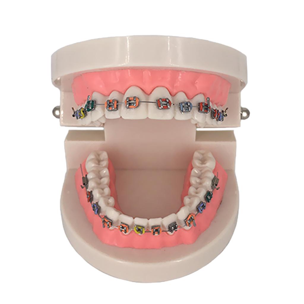 Orthodontic Dental Teaching Model Tooth Care Teaching Education Supplies
