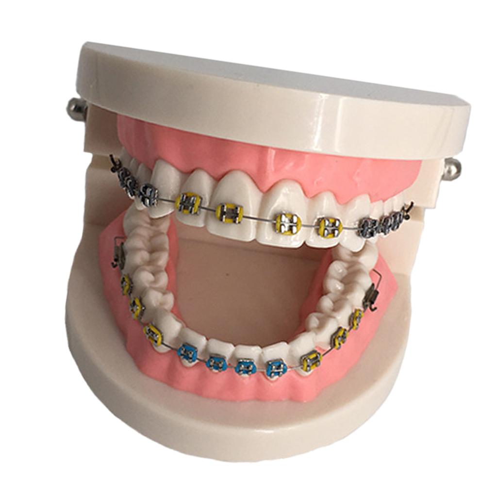 Orthodontic Dental Teaching Model Tooth Care Teaching Education Supplies