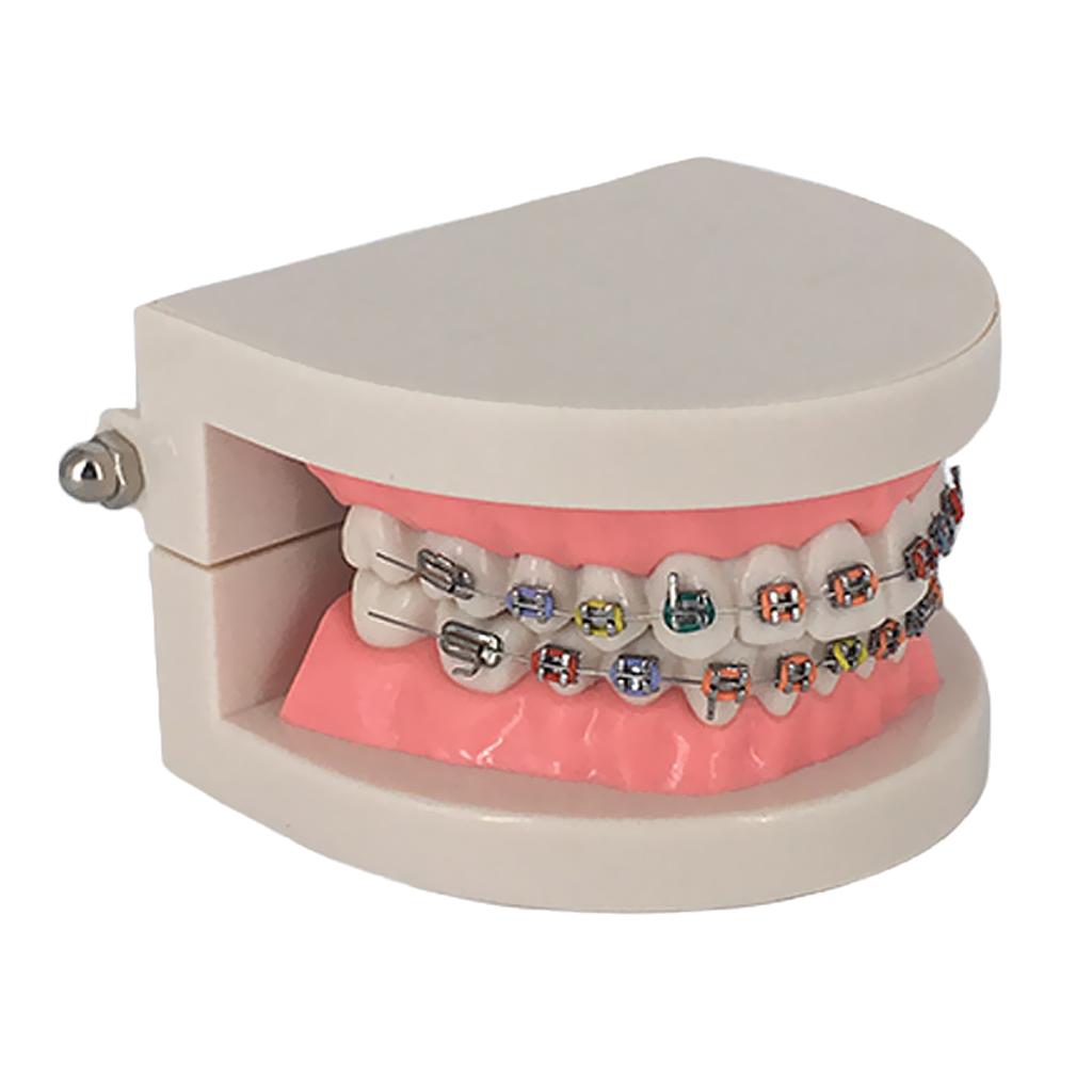 Orthodontic Dental Teaching Model Tooth Care Teaching Education Supplies