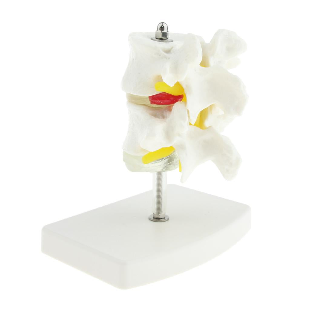 2-Section Life-Size Lumbar Vertebrae Model Teaching Tool with Base