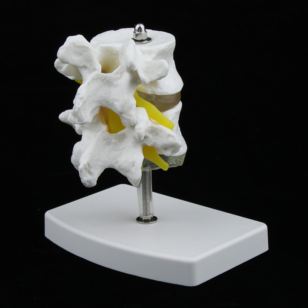 2-Section Life-Size Lumbar Vertebrae Model Teaching Tool with Base