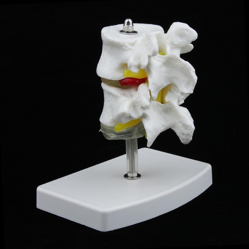 2-Section Life-Size Lumbar Vertebrae Model Teaching Tool with Base