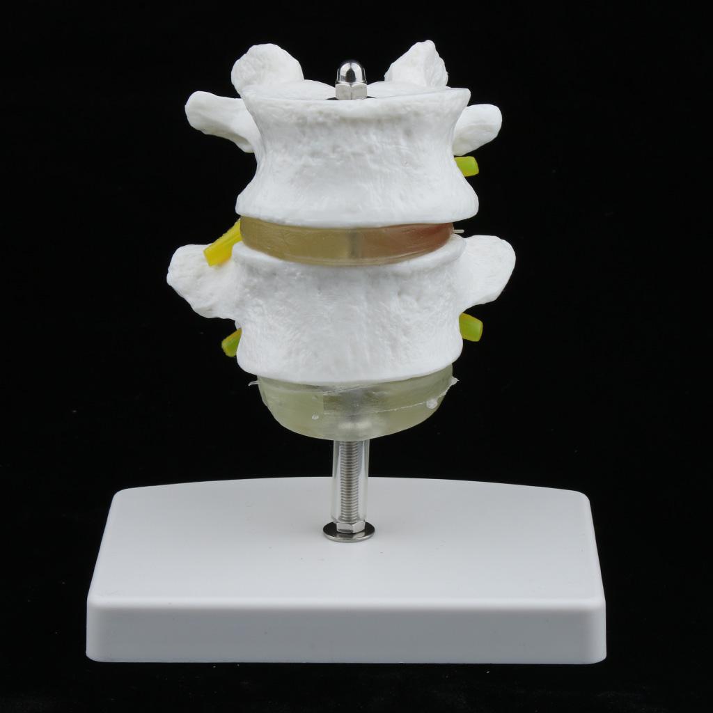 2-Section Life-Size Lumbar Vertebrae Model Teaching Tool with Base