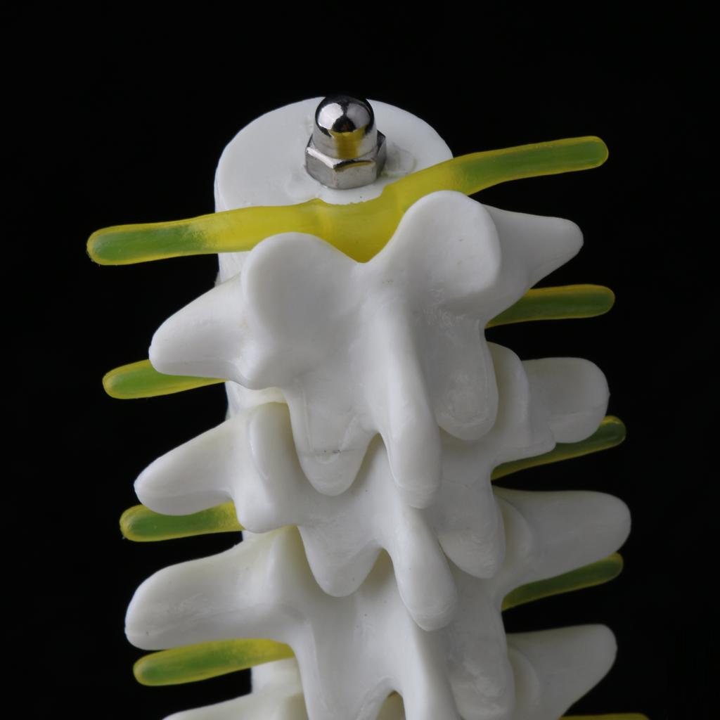 Mini Pelvis with 5 Lumbar Vertebrae Skeleton Anatomical Model